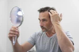 Immagine che illustra il trapianto di capelli a prezzi accessibili in Albania