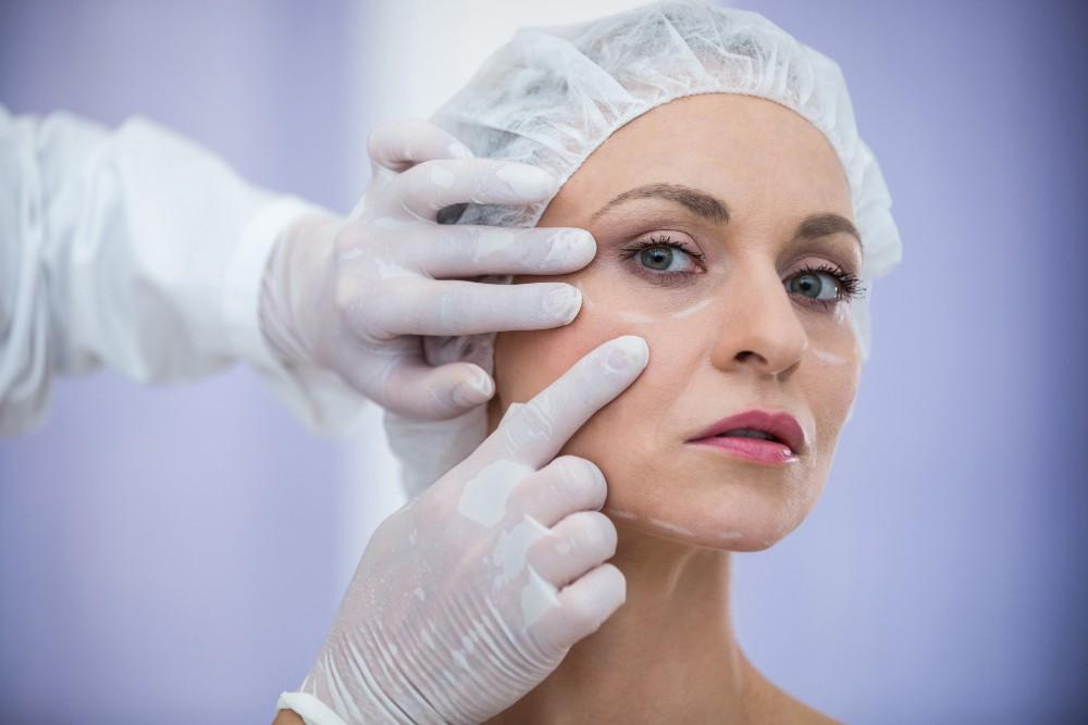 Image illustrating a facelift procedure at a medical clinic in Albania