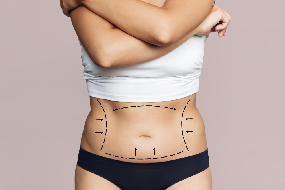 Affordable abdominoplasty in Albania