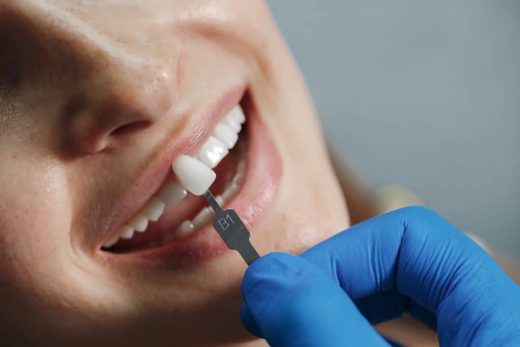 Woman receiving dental veneer treatment in Albania for medical tourism.