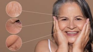 Woman with aging skin, showing effects of age, skin quality, and lifestyle.
