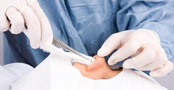 Surgeon performing rhinoplasty procedure in a medical clinic in Albania.