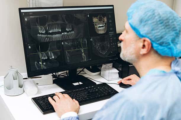 Dentist reviewing dental X-ray images for All-on-4 and All-on-6 implants in Albania.